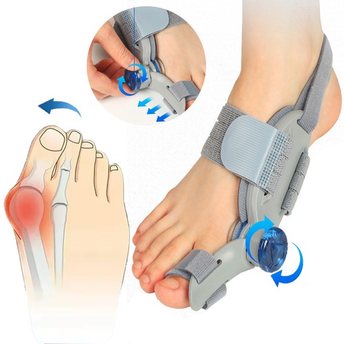 Bunion fix toe hallux - bunion,